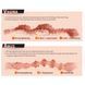 Kokos Olivia Say 2WayPlus Masturbator with Vibration and Massage &ndash; Realistic Female Pelvis, Dual Entry SO2556 - photos (5