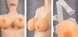 Silicone breast prostheses - Strap-on Silicone Breasts 42-24607935001 - photos (7
